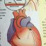 heart - angiogram